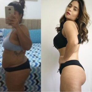 FERNANDA - 31KG